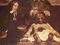 «Урок анатомии доктора Деймана». Рембрандт, 1656