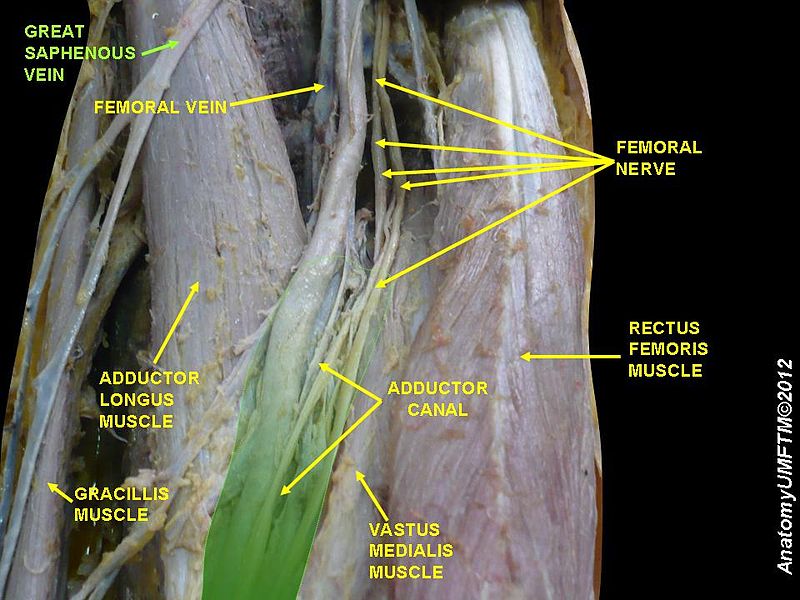 File:Slide1FFFFF.JPG