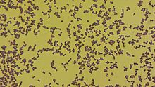 Aerococcus urinae - microscopy.jpg