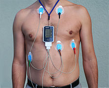 Holter de 5 elèctrodes