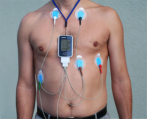 Alex CM4000, electrocardiography ekg/ecg