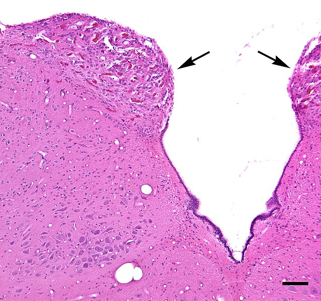 File:Area postrema micrograph.jpg