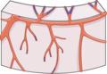 Myocardial perfusion 3