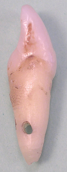 File:Centralincisordistal06-06-06.jpg