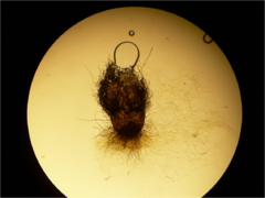 Chaetonium (Acremonium) perithecium 40X.png