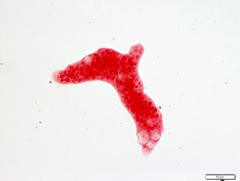 File:Collection Penard MHNG Specimen 19-1-5 Amoeba laureata.tif