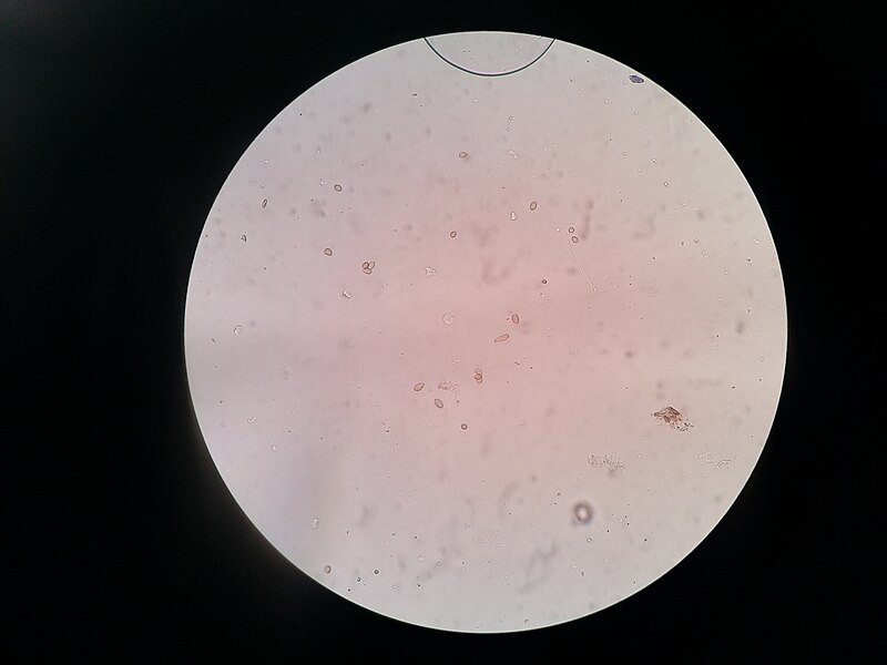 File:Conidia of Scedosporium.jpg