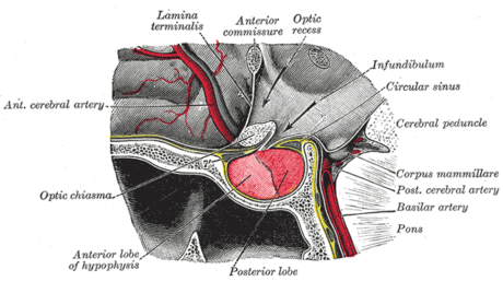 Hypopituitarism