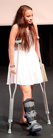 A girl using a pair of underarm / axillary crutches Me on crutches.jpg