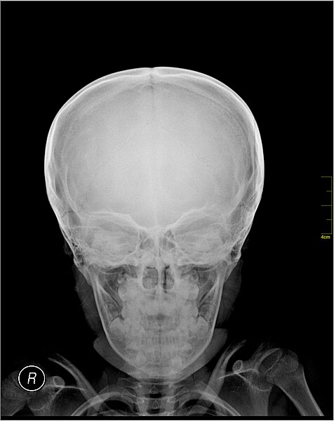 File:Medical X-Ray imaging ORA06 nevit.jpg
