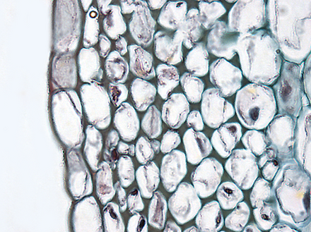 Cross section of collenchyma cells