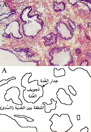 Prostatehistology-ar.jpg