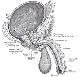 Spanner insitu.jpg