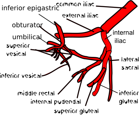 Tập_tin:Variation_4_of_internal_iliac_artery_branching.svg