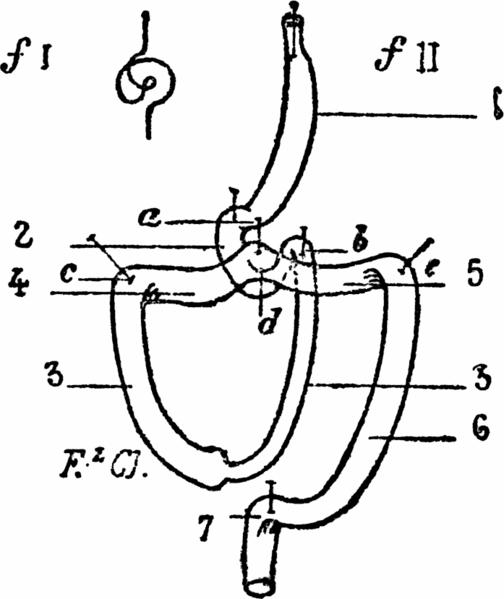 File:De la sangle pelvienne contre l'Entéroptose - 16fig1.png