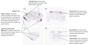 In Situ Hybridization on Mouse Spinal Column and Cervical Spine. (a)-(c) spinal column of juvenile mouse (P4) and (d) cervical spine of adult mouse (P56). In Situ Hybridization - Mouse Spine - SLC46A3.png