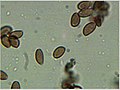 spores