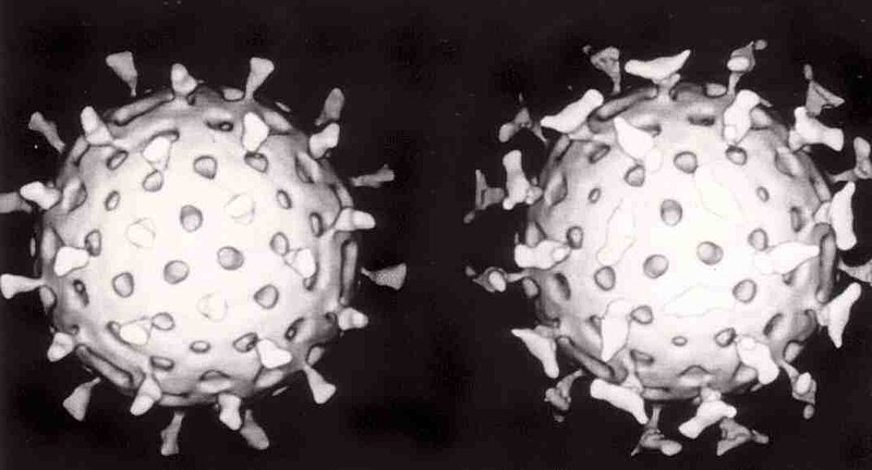 File:Rotavirus with antibody.jpg
