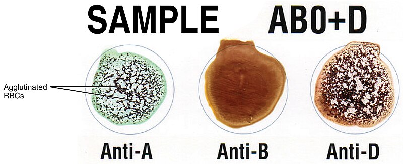 File:1912 Cross Matching Blood Types.jpg