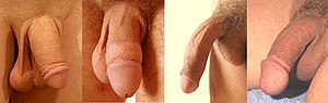 Beschneidungsstile, Styles of Circumcision.jpg