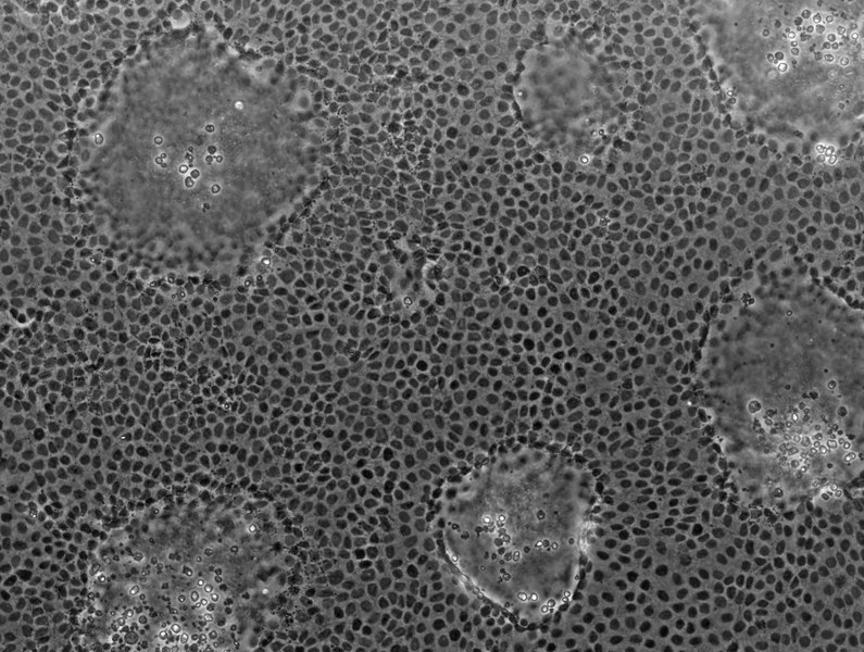 File:CaCo-2 cells after 21 days in culture.tif