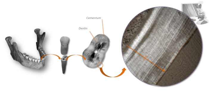 File:Cementochronology.tif