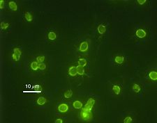 Cryptosporidium parvum