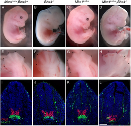Embryons avec mutation dans Mks1krc, une cause du syndrome de Meckel.png