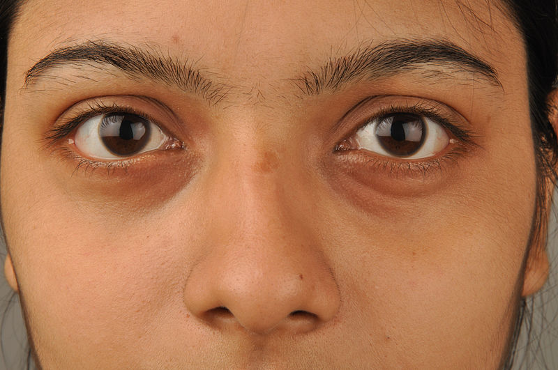 File:Eyes & Nose 5783.JPG