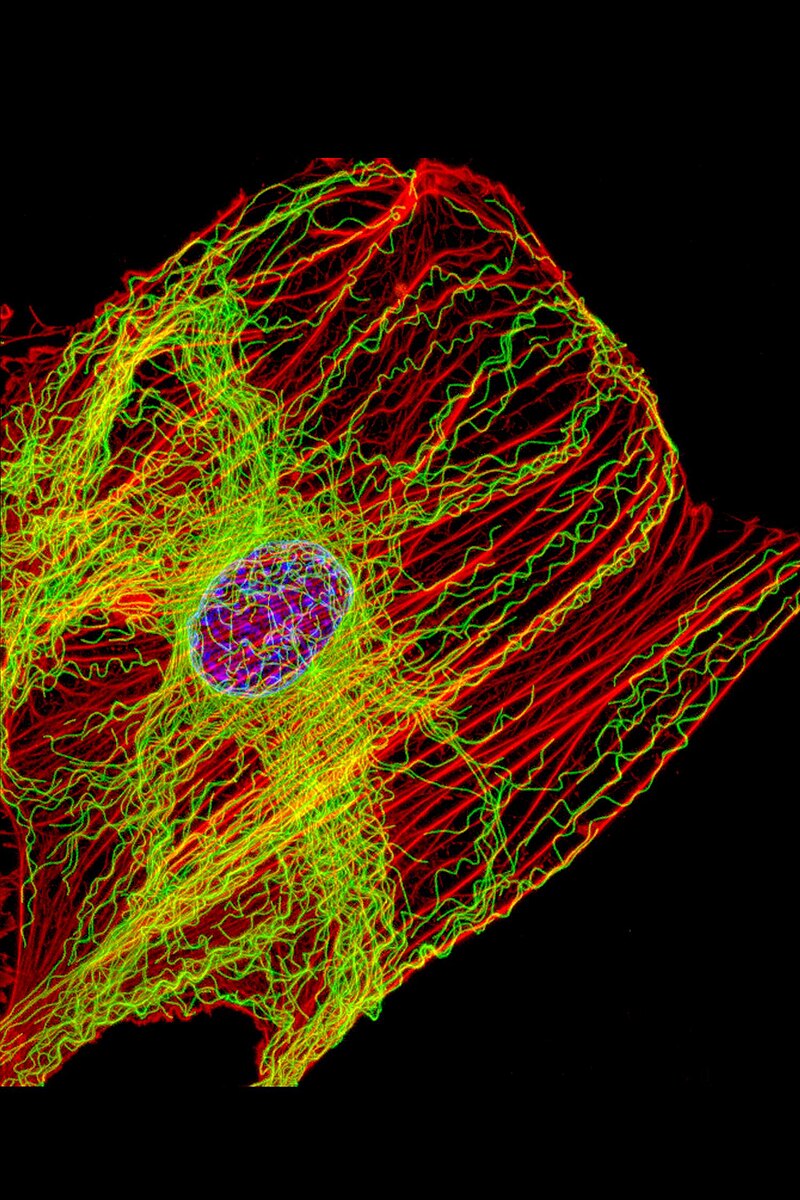 800px-Fluorescent_image_fibroblast.jpg