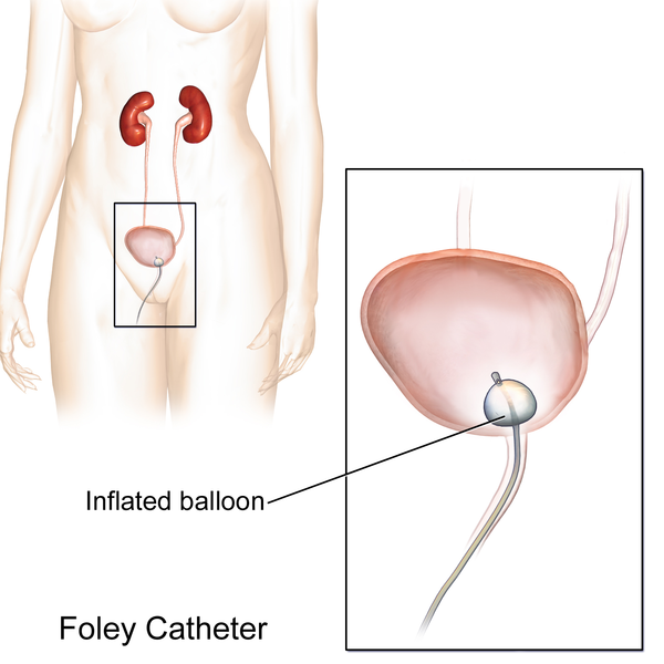 File:Foley Catheter.png