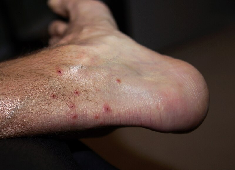 File:Foot-lr.jpg