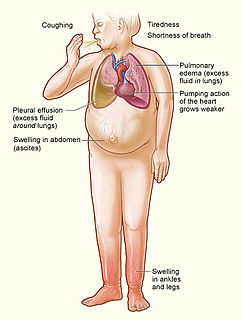 Heart failure Failure of the heart to provide sufficient blood flow