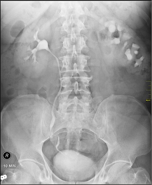 File:Medical X-Ray imaging BFF02 nevit.jpg