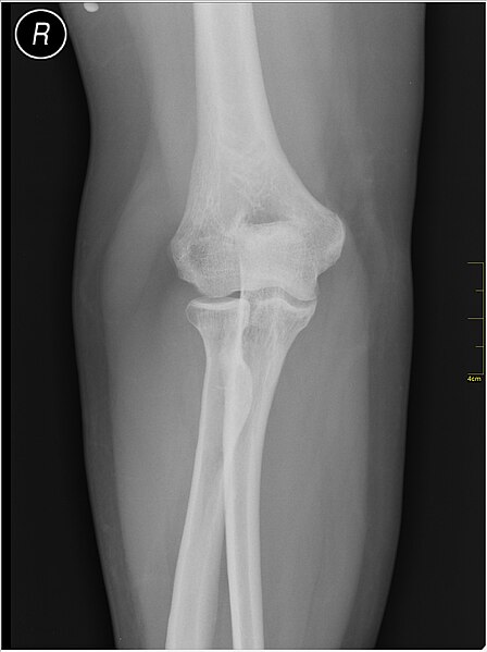 File:Medical X-Ray imaging OQH06 nevit.jpg