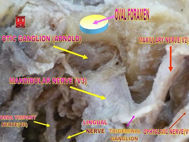 File:Otic ganglion.jpg