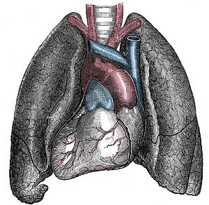 Situs inversus - Mirrored heart and lungs.jpg