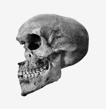 Tập_tin:Akhenaten_skull_rotated_profile.png