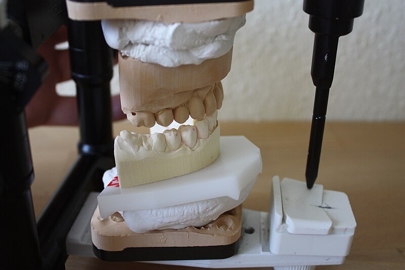 File:Articulator Artex 2 004.JPG