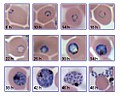 Stadiile evoluției parazitului P. falciparum în interiorul sângelui gazdei pe parcursul a două zile.