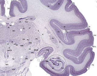 Cerebral cortex Part of the mammalian brain