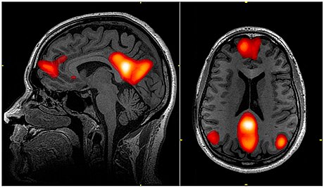 Default mode network