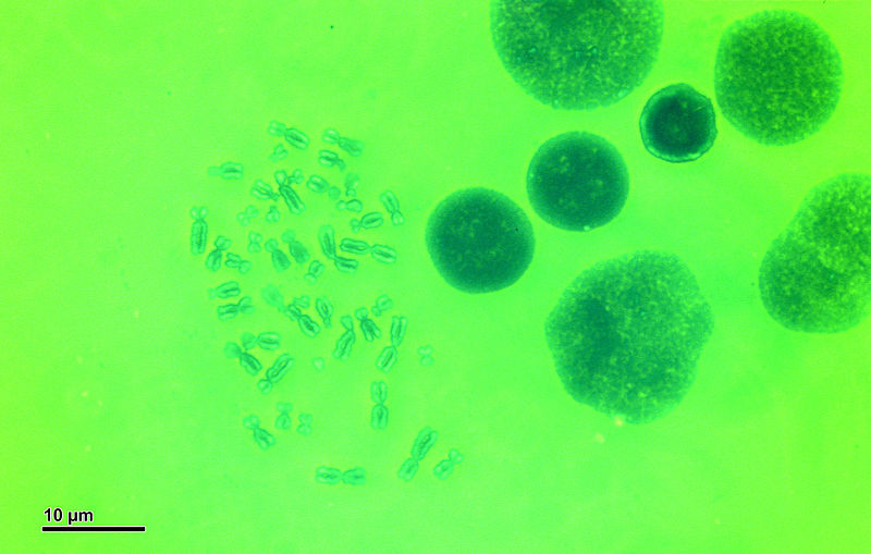 File:Human karyotype (248 26) Karyotype Human, green filter.jpg