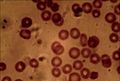 Lo sang es una suspension colloïdala de particulas solidas dins una fasa aquosa.