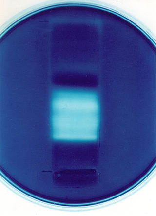 <span class="mw-page-title-main">Zymography</span> Electrophoretic hydrolytic enzyme detection technique