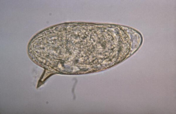 Schistosoma mansoni