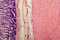 Tissue layers of the small intestine (mucosa, submucosa & muscularis).jpg