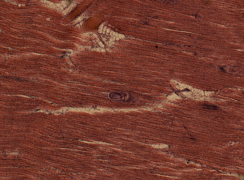 File:Trichinella spiralis (YPM IZ 095183).jpeg