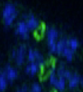 Super-resolution image of Z-rings (green) at different stages of constriction in two E. coli cells. Zrings.png