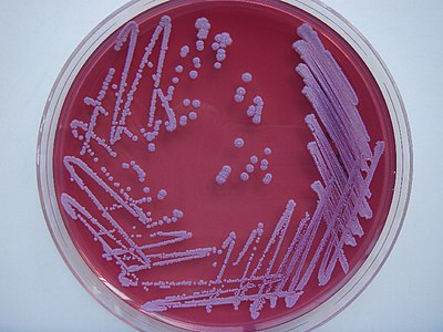 Палочка петри. Escherichia coli микробиология. Колибактериоз микробиология. Колибактериоз на Эндо. 5. Грамположительные палочки. Энтеробактерии..